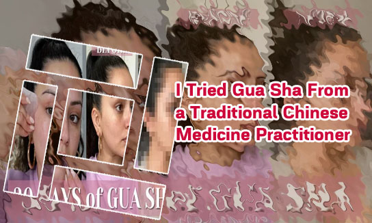 Gua sha double chin before and after
